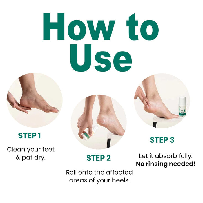 D-Fame Advanced Feet Roll-On – 25% Urea Heel Repair Formula