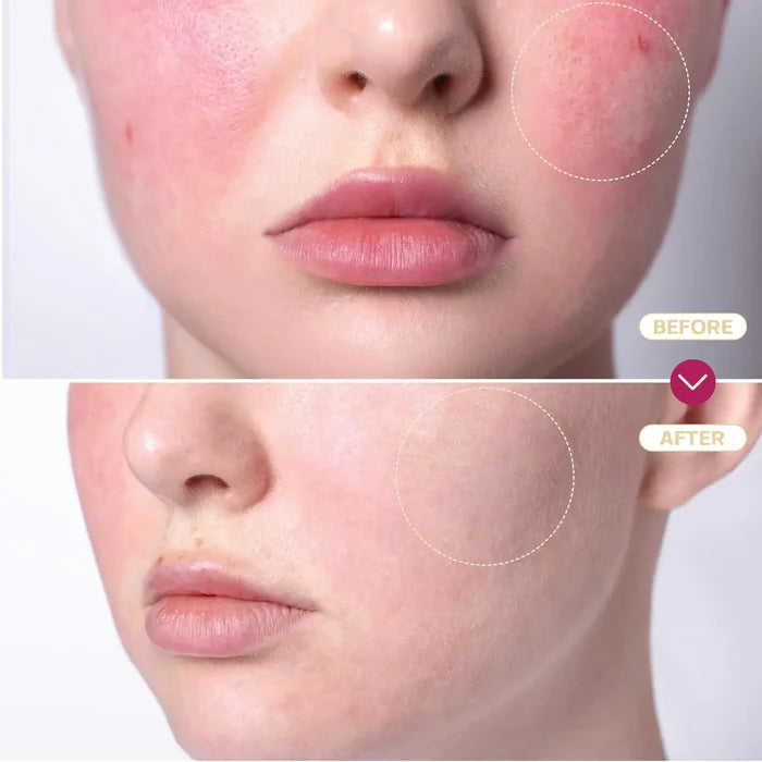 Hypochlorous Acid Spray for Skin & Face