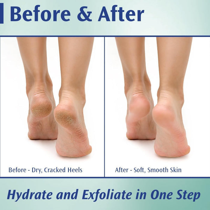 Podiatrists' Choice Callus Control Cream Foot Moisturizer, 4-ounce Jar